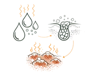 A medical infographic illustrating the Physical Causes (Pitta, Kapha Imbalance) Causes of Acne and Pimples, showing excess sebum production and clogged pores leading to inflammatory skin eruptions.