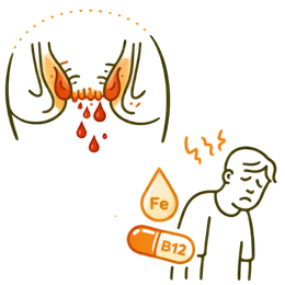 Line art illustration of a person feeling fatigued and weak with symbols for iron (Fe) and vitamin B12 deficiency next to a diagram of heavy menstrual bleeding, representing the risk of anemia as a complication of untreated irregular periods.