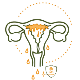 Line art illustration of a uterus with an thickened orange endometrial lining and a cancer awareness ribbon symbol, representing the risk of endometrial cancer as a complication of PCOS.