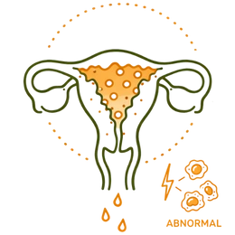 Line art illustration of a uterus with an abnormally thickened and spotted orange endometrial lining, representing the risk of endometrial hyperplasia as a complication of untreated hormonal imbalances.