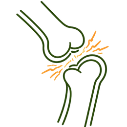 Bone-on-Bone Friction and Cartilage Erosion Risks