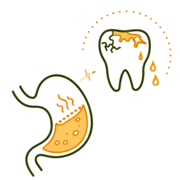 A detailed medical illustration showing the dental erosion risk & complications of acidity, featuring the thinning of tooth enamel caused by chronic acid reflux and gastric juices.