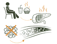 A medical infographic illustrating the Lifestyle Causes (Sedentary Habits) Causes of Diabetes, showing the impact of a lack of physical activity and high-sugar diets on pancreatic function and blood sugar levels.