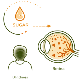A medical illustration showing damage to the retina caused by high blood sugar, featuring icons for vision loss and blindness, representing the Diabetic Retinopathy Risks & Complications: The Silent Damage of High Sugar.