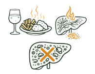 A medical infographic illustrating the lifestyle causes of fatty liver disease, showing the impact of alcohol consumption, fried foods, and weakened metabolic fire on liver health.