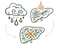 A medical infographic illustrating the Physical Causes of Fatty Liver Disease, showing the transition from a healthy liver with balanced metabolic fire to a congested liver alongside symbolic icons of rain and wind representing Kapha and Vata imbalances.