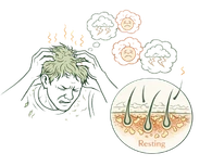 Mental stress and emotional anxiety leading to hair thinning and the resting phase of hair follicles.