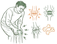 Physical Causes of Joint Pain and Knee Arthritis