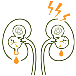 An icon-style illustration showing damaged kidneys with structural cracks and protein leakage, representing the need for the Better Insulin Sensitivity Benefits of Ayurvedic Treatment for Diabetes to prevent renal failure.