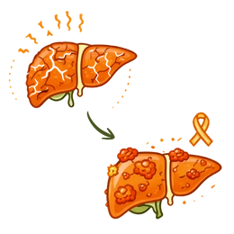 A medical illustration showing the transition from a scarred liver to Liver Cancer (HCC), highlighting the critical Risks & Complications of Untreated Fatty Liver Disease and the formation of malignant tumors.