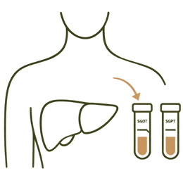An icon-style illustration of a human torso and liver with blood test vials showing SGOT and SGPT, highlighting the Lowers Enzymes Benefits of Ayurvedic Treatment for Fatty Liver.