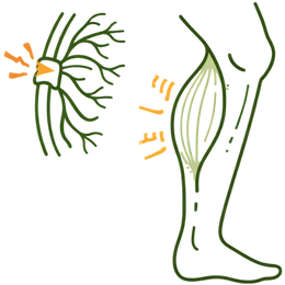 Icon showing muscle wasting in the leg due to chronic nerve compression and untreated sciatica.
