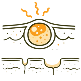 A medical infographic illustrating the Permanent Scarring Risks & Complications of Acne is Ignored, showing the progression from an inflamed cyst to deep pit marks and structural skin damage.