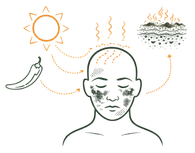 Lifestyle Causes of Skin Pigmentation Melasma