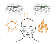Physical Causes of Pigmentation and Melasma