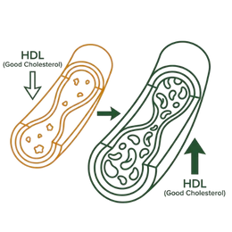 A medical infographic showing an increase in HDL (good cholesterol) within the blood vessels, representing the raised HDL benefits of Ayurvedic treatment for high cholesterol.