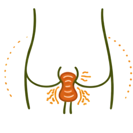 A medical diagram illustrating Rectal Prolapse as one of the severe Risk Factors for Constipation, showing the displacement of rectal tissue caused by chronic straining and weakened pelvic muscles.