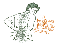 Illustration showing a person with back pain and a diagram of disc degeneration and nerve compression.