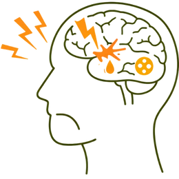 Icon of a human head with a brain showing signs of hemorrhage and blockage representing the risk of stroke due to high blood pressure.